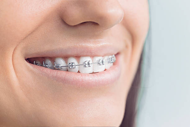 Dental Inlays and Onlays in Gnadenhutten, OH